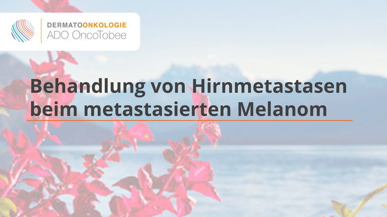 behandlung von hirnmetastasen beim metastasierten melanom titelbild