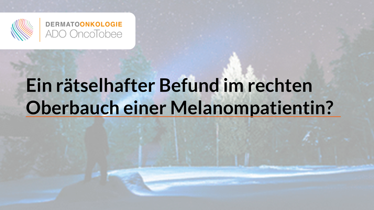 ein rã tselhafter befund im rechten oberbauch einer melanompatientin titelbild