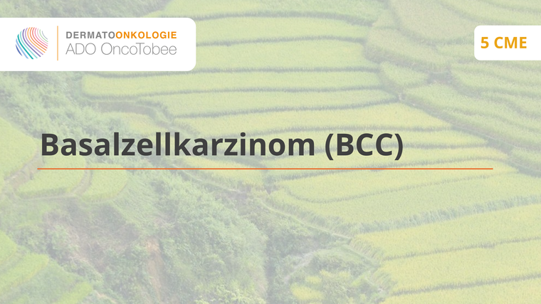 basalzellkarzinom bcc titelbild