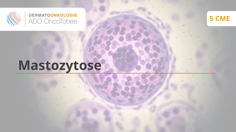 mastozytose