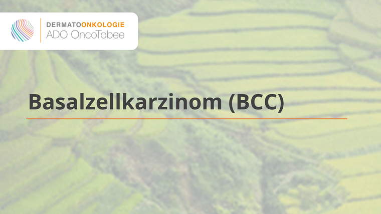 basalzellkarzinom bcc titelbild