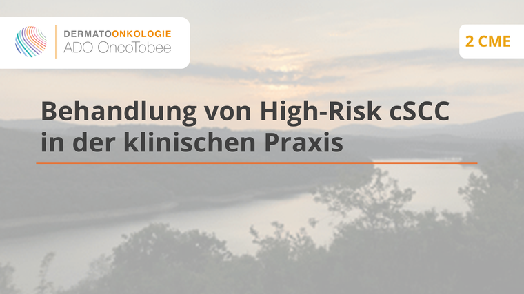 behandlung von high risk cscc in der klinischen praxis titelbild