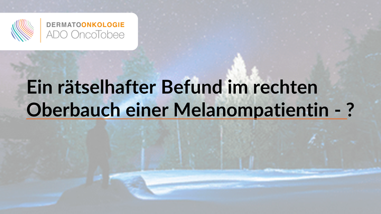 ein rã tselhafter befund im rechten oberbauch einer melanompatientin titelbild