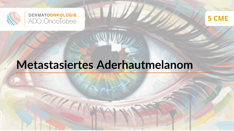 metastasiertes aderhautmelanom titelbild