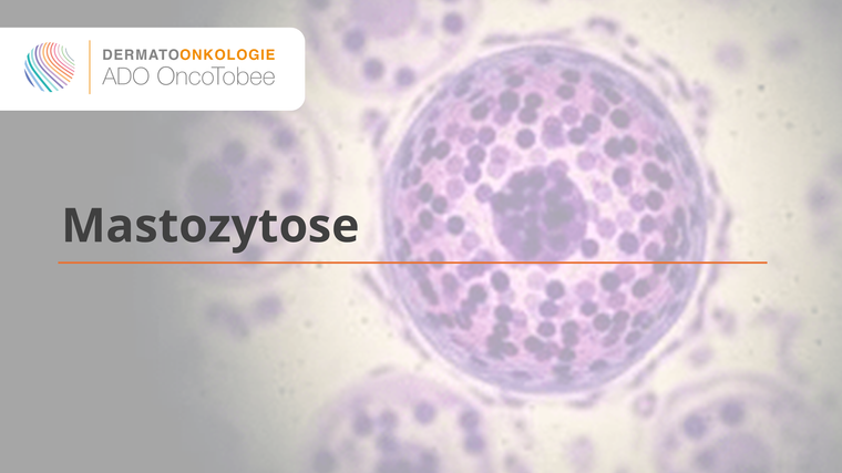 mastozytose